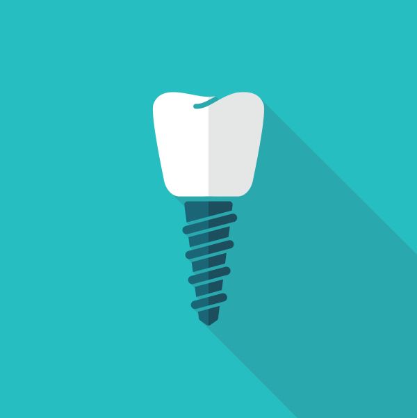 Facts And Myths About Dental Implants You Need To Know