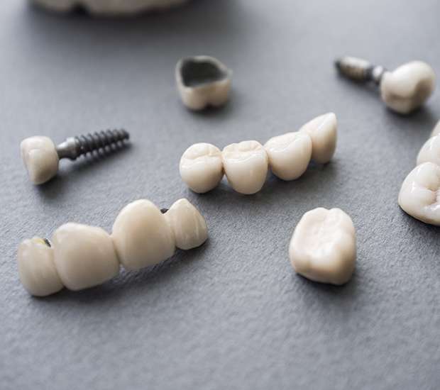Davenport The Difference Between Dental Implants and Mini Dental Implants